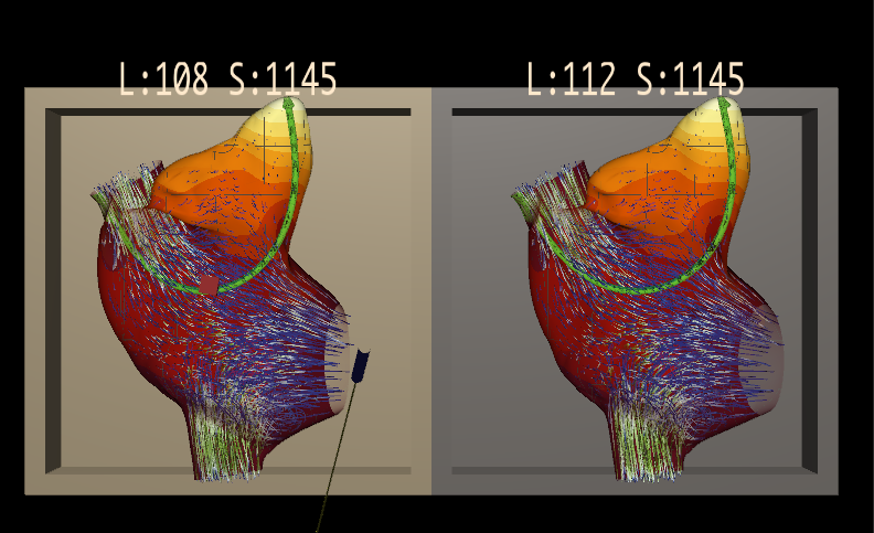 Different volumes of the heart can be visualized
